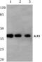 ALX Homeobox 3 antibody, PA5-36138, Invitrogen Antibodies, Western Blot image 