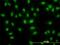 DEAD-Box Helicase 56 antibody, H00054606-M05, Novus Biologicals, Immunocytochemistry image 