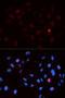 Cyclin Dependent Kinase 1 antibody, STJ22058, St John