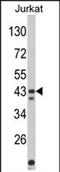 Haloacid Dehalogenase Like Hydrolase Domain Containing 5 antibody, PA5-72530, Invitrogen Antibodies, Western Blot image 