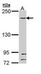 Structural Maintenance Of Chromosomes 1B antibody, GTX111941, GeneTex, Western Blot image 