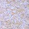 DEAD-Box Helicase 1 antibody, LS-C334806, Lifespan Biosciences, Immunohistochemistry paraffin image 