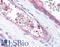 Kinase Insert Domain Receptor antibody, LS-C181010, Lifespan Biosciences, Immunohistochemistry paraffin image 