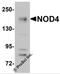 NLR Family CARD Domain Containing 5 antibody, 5951, ProSci, Western Blot image 