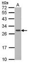GTPase, IMAP Family Member 6 antibody, GTX107241, GeneTex, Western Blot image 