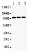 Amyloid Beta Precursor Like Protein 1 antibody, PA2096, Boster Biological Technology, Western Blot image 