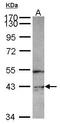 Phosphatidylinositol-5-Phosphate 4-Kinase Type 2 Gamma antibody, GTX119713, GeneTex, Western Blot image 