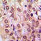 Akt antibody, LS-C354246, Lifespan Biosciences, Immunohistochemistry frozen image 
