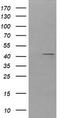 Parvin Alpha antibody, TA505998, Origene, Western Blot image 