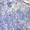 Bruton Tyrosine Kinase antibody, LS-C331556, Lifespan Biosciences, Immunohistochemistry frozen image 