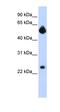 FOS Like 1, AP-1 Transcription Factor Subunit antibody, orb329599, Biorbyt, Western Blot image 