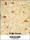 DIRAS Family GTPase 1 antibody, 63-928, ProSci, Immunohistochemistry paraffin image 