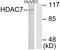Histone Deacetylase 7 antibody, LS-C118482, Lifespan Biosciences, Western Blot image 