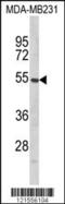 Protein Prenyltransferase Alpha Subunit Repeat Containing 1 antibody, 63-553, ProSci, Western Blot image 