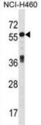 Islet cell autoantigen 1 antibody, abx029076, Abbexa, Western Blot image 
