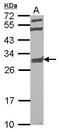 Protein NipSnap homolog 2 antibody, GTX123416, GeneTex, Western Blot image 