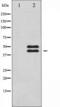 Vasodilator Stimulated Phosphoprotein antibody, TA325964, Origene, Western Blot image 