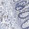 Collagen Type I Alpha 1 Chain antibody, HPA008405, Atlas Antibodies, Immunohistochemistry frozen image 