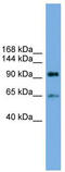 Exocyst Complex Component 6 antibody, TA344823, Origene, Western Blot image 