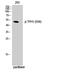 Tryptophan Hydroxylase 1 antibody, A01626S58, Boster Biological Technology, Western Blot image 