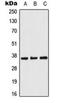 Acetyl-CoA Acyltransferase 1 antibody, orb341295, Biorbyt, Western Blot image 