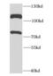DEAD-Box Helicase 20 antibody, FNab02298, FineTest, Western Blot image 