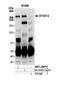 SLX4 Structure-Specific Endonuclease Subunit antibody, NBP1-28679, Novus Biologicals, Western Blot image 