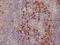 Cytotoxic T-Lymphocyte Associated Protein 4 antibody, CSB-RA213310A0HU, Cusabio, Immunohistochemistry paraffin image 