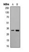 Ubiquitin Protein Ligase E3 Component N-Recognin 1 antibody, orb393180, Biorbyt, Western Blot image 