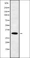 Latent Transforming Growth Factor Beta Binding Protein 1 antibody, orb336376, Biorbyt, Western Blot image 