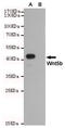 Wnt Family Member 5B antibody, STJ99295, St John