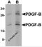 Platelet Derived Growth Factor Subunit B antibody, 7199, ProSci Inc, Western Blot image 