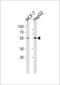 Cytochrome P450 Family 2 Subfamily W Member 1 antibody, GTX81289, GeneTex, Western Blot image 