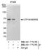 UTP18 Small Subunit Processome Component antibody, NB100-77295, Novus Biologicals, Immunoprecipitation image 