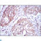 Methylenetetrahydrofolate Reductase antibody, LS-C812711, Lifespan Biosciences, Immunohistochemistry paraffin image 