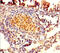 Protein FAM161A antibody, CSB-PA661553LA01HU, Cusabio, Immunohistochemistry paraffin image 