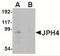 Junctophilin 4 antibody, NBP2-41095, Novus Biologicals, Western Blot image 