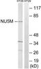 Mitochondrially Encoded NADH:Ubiquinone Oxidoreductase Core Subunit 5 antibody, LS-C120129, Lifespan Biosciences, Western Blot image 