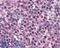 FA Complementation Group G antibody, 45-567, ProSci, Immunohistochemistry paraffin image 
