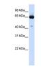 Solute Carrier Family 39 Member 4 antibody, NBP1-59789, Novus Biologicals, Western Blot image 