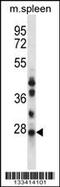 N-Ribosyldihydronicotinamide:Quinone Reductase 2 antibody, 57-889, ProSci, Western Blot image 