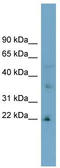 Low Density Lipoprotein Receptor Class A Domain Containing 1 antibody, TA336121, Origene, Western Blot image 