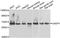 Carnosine Dipeptidase 1 antibody, A06263, Boster Biological Technology, Western Blot image 