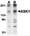 Mitogen-Activated Protein Kinase Kinase Kinase 5 antibody, 3679, ProSci, Western Blot image 