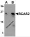 BCAS2 Pre-MRNA Processing Factor antibody, 5627, ProSci Inc, Western Blot image 
