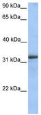 Electron transfer flavoprotein subunit alpha, mitochondrial antibody, TA336249, Origene, Western Blot image 
