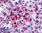 Bombesin Receptor Subtype 3 antibody, LS-A24, Lifespan Biosciences, Immunohistochemistry paraffin image 