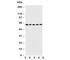 Iduronate 2-Sulfatase antibody, R31017, NSJ Bioreagents, Western Blot image 