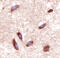Vasoactive Intestinal Peptide Receptor 2 antibody, MAB5416, R&D Systems, Immunohistochemistry paraffin image 