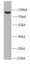 85 kDa calcium-independent phospholipase A2 antibody, FNab04372, FineTest, Western Blot image 